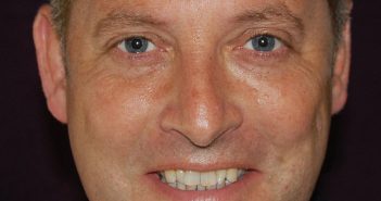 Anthony Daniels Head of Sales for Hurtigruten