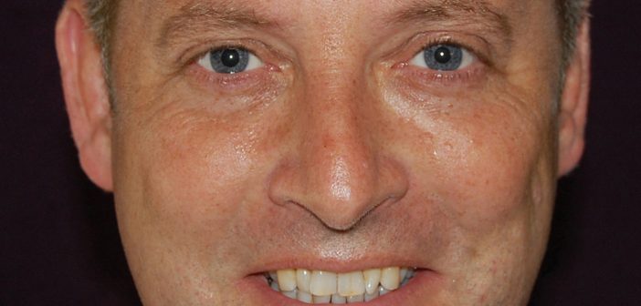 Anthony Daniels Head of Sales for Hurtigruten