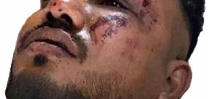 Vishwash Kumar Ramesh air india crash survivor